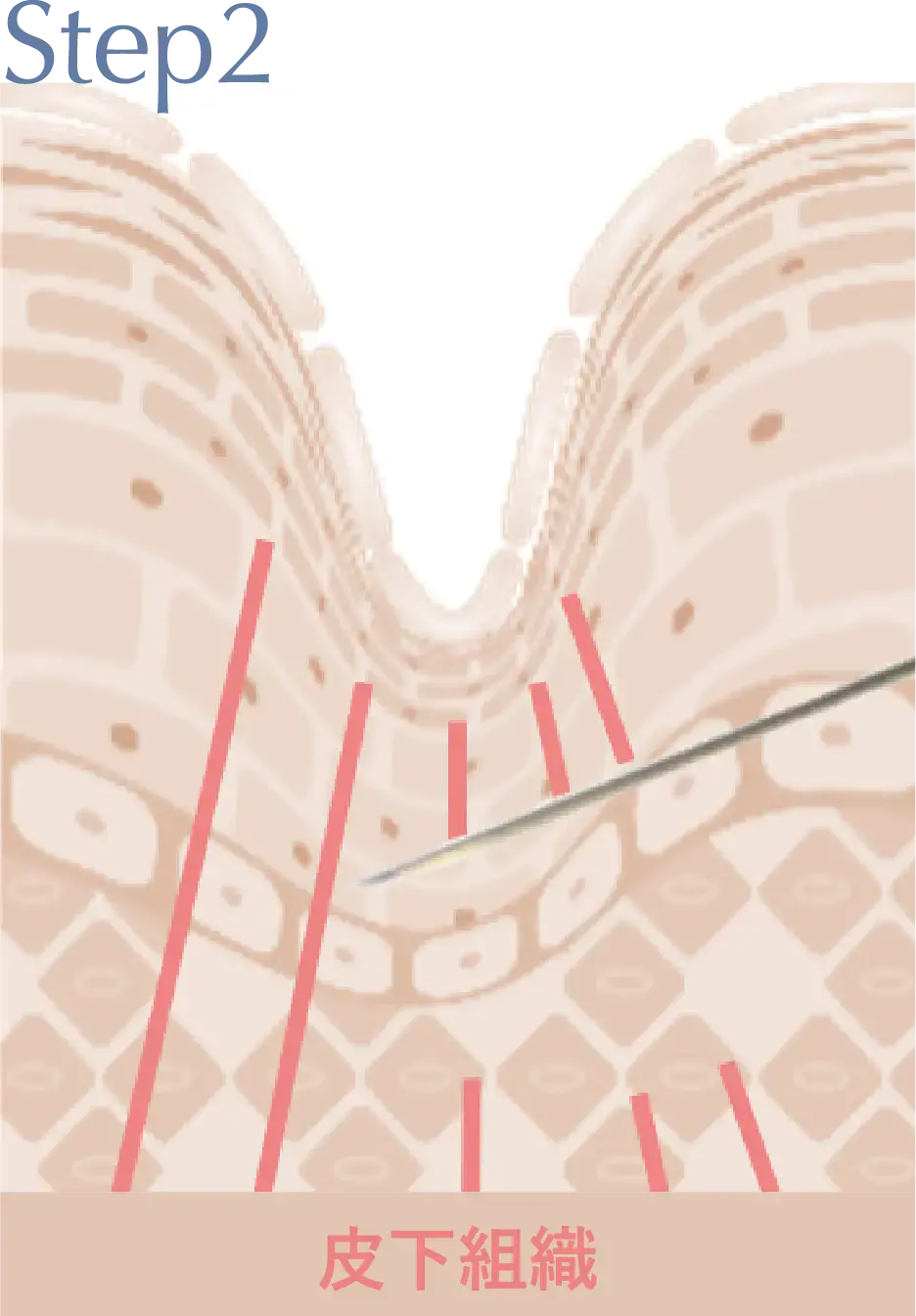 Step2 皮下組織の画像